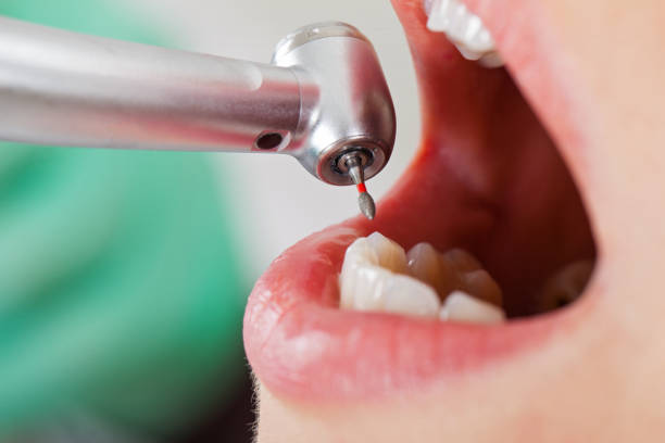 Best Emergency Dentist for Knocked-Out Tooth in Roland, OK